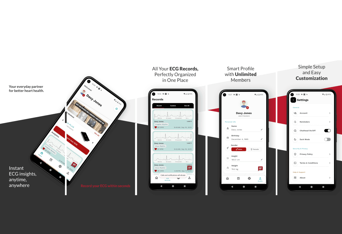 Preview of the My ECG AI mobile application interface